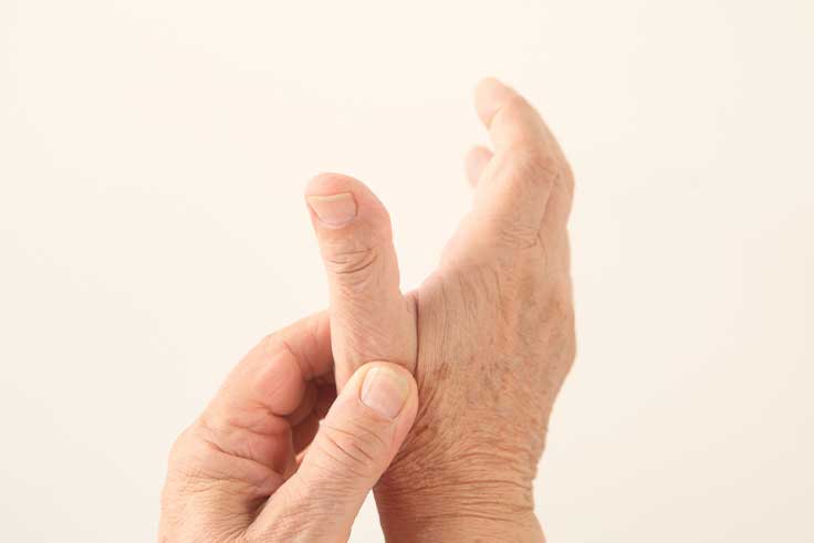 Arthritis - Base of Thumb - Ozark Orthopaedics